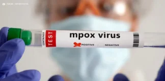 Casos de Mpox sobem para 13 em Minas Gerais e Secretaria de Saúde reforça medidas de prevenção