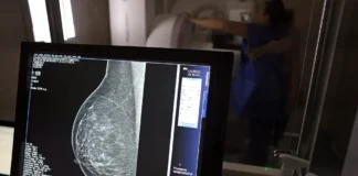 Planos de saúde terão que cobrir mamografia para mulheres de todas as idades